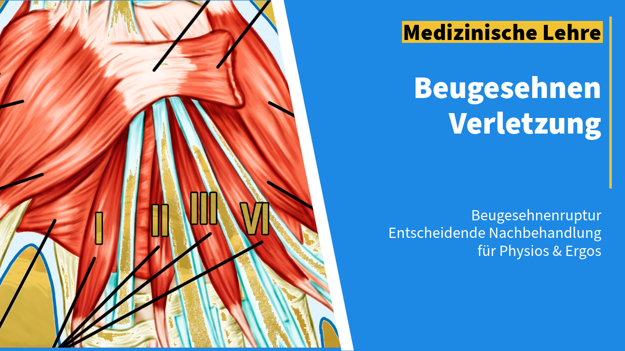 Medizinische Illustration der Beugesehnen mit nummerierten Markierungen für therapeutische und diagnostische Zwecke