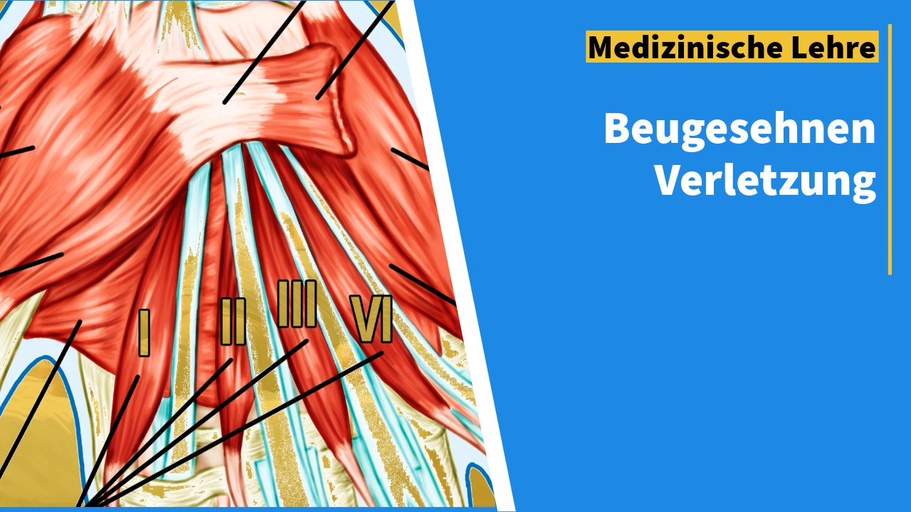 Medizinische Illustration der Beugesehnen mit nummerierten Markierungen für therapeutische und diagnostische Zwecke