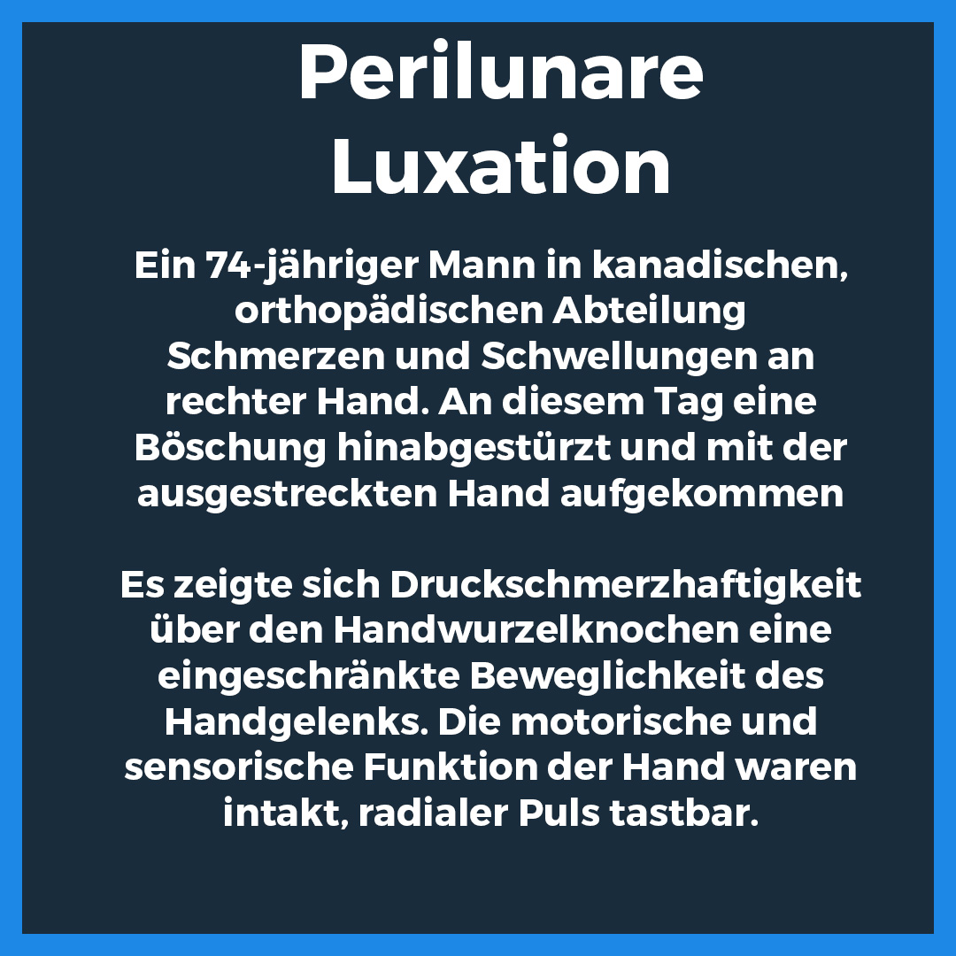 Röntgenaufnahmen einer perilunaren Luxation des rechten Handgelenks in dorsopalmarer und seitlicher Ansicht. Die Bilder zeigen eine Fehlstellung des Lunatums mit markierten Bereichen zur besseren Visualisierung der Dislokation. Zusätzlich eine Texttafel mit Fallbeschreibung eines 74-jährigen Patienten, der mit Schmerzen und Schwellungen nach einem Sturz vorgestellt wurde.